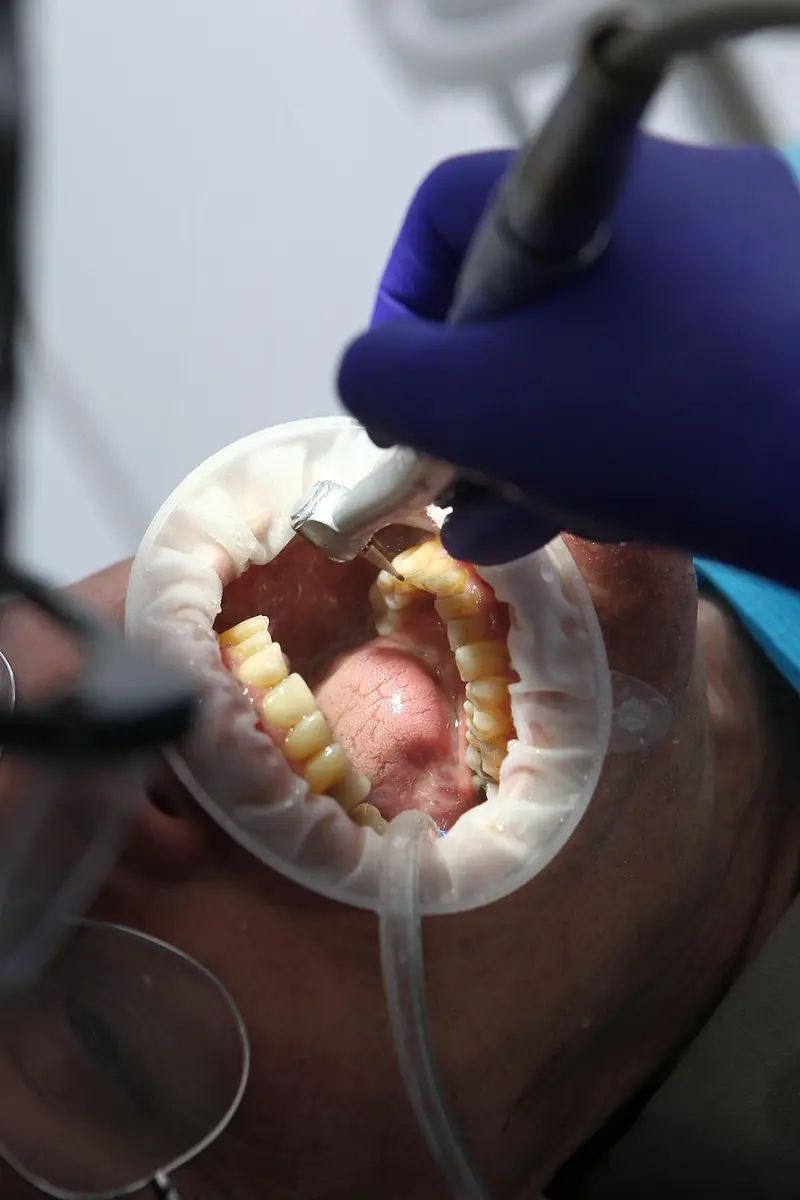 how to use frankincense for oral health oil pulling